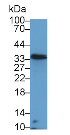 Polyclonal Antibody to Oncostatin M (OSM)