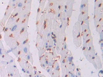 Polyclonal Antibody to Oncostatin M (OSM)