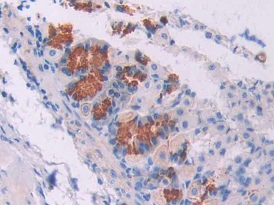 Polyclonal Antibody to Oncostatin M (OSM)