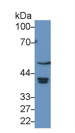 Polyclonal Antibody to Betacellulin (bTC)