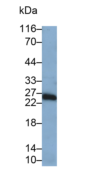 Polyclonal Antibody to Placenta Growth Factor (PLGF)