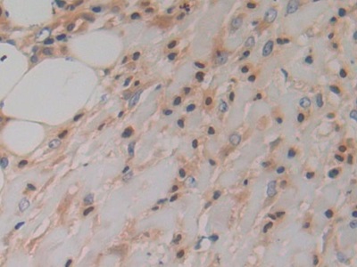 Polyclonal Antibody to Prokineticin 2 (PK2)