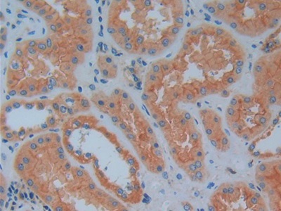 Polyclonal Antibody to Prokineticin 2 (PK2)