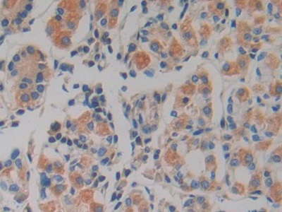 Polyclonal Antibody to Prokineticin 2 (PK2)