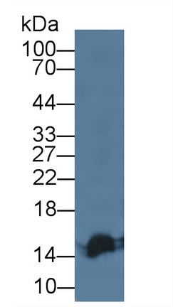 Polyclonal Antibody to Regulated On Activation In Normal T-Cell Expressed And Secreted (RANTES)