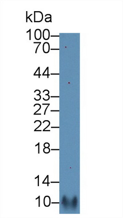 Polyclonal Antibody to Regulated On Activation In Normal T-Cell Expressed And Secreted (RANTES)