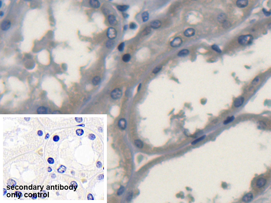 Polyclonal Antibody to Superoxide Dismutase 3, Extracellular (SOD3)