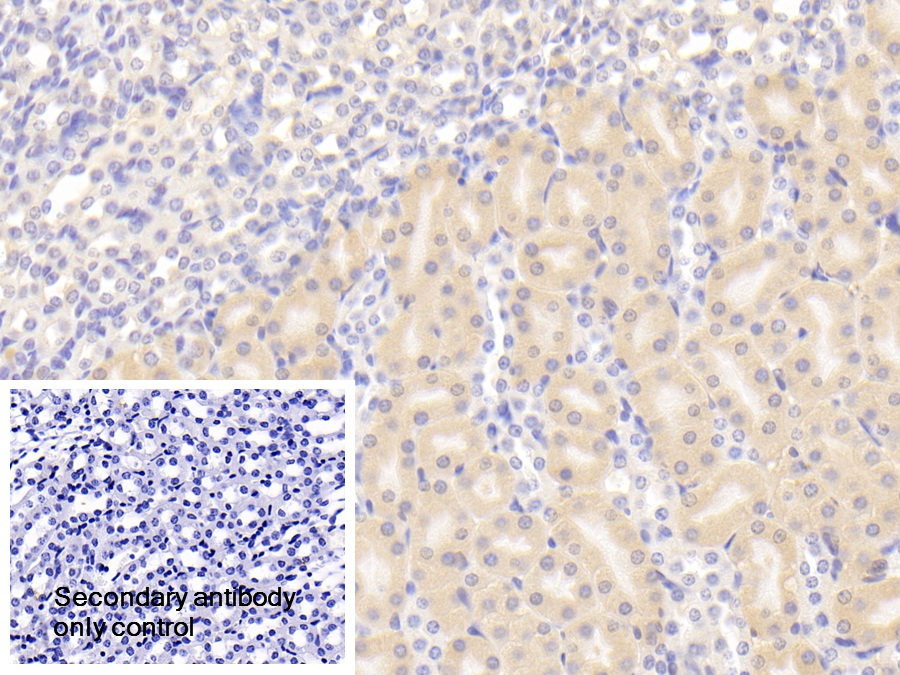 Polyclonal Antibody to Superoxide Dismutase 3, Extracellular (SOD3)