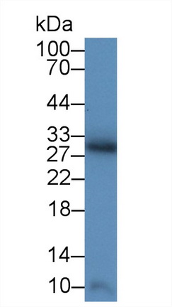 Polyclonal Antibody to Superoxide Dismutase 3, Extracellular (SOD3)