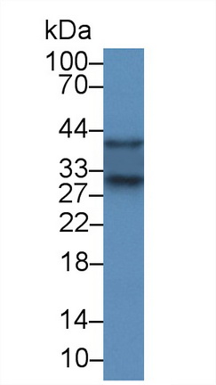 Polyclonal Antibody to Superoxide Dismutase 3, Extracellular (SOD3)