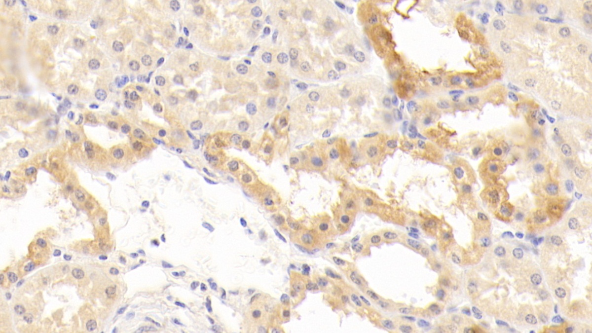 Polyclonal Antibody to Cluster Of Differentiation 40 Ligand (CD40L)