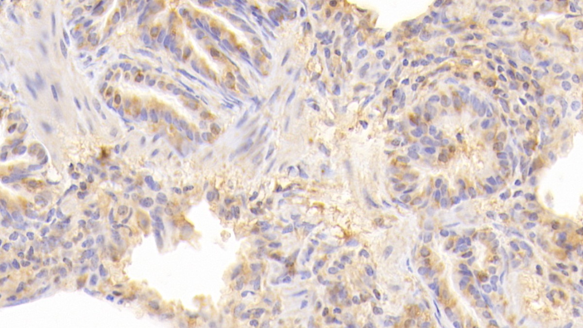 Polyclonal Antibody to Cluster Of Differentiation 40 Ligand (CD40L)