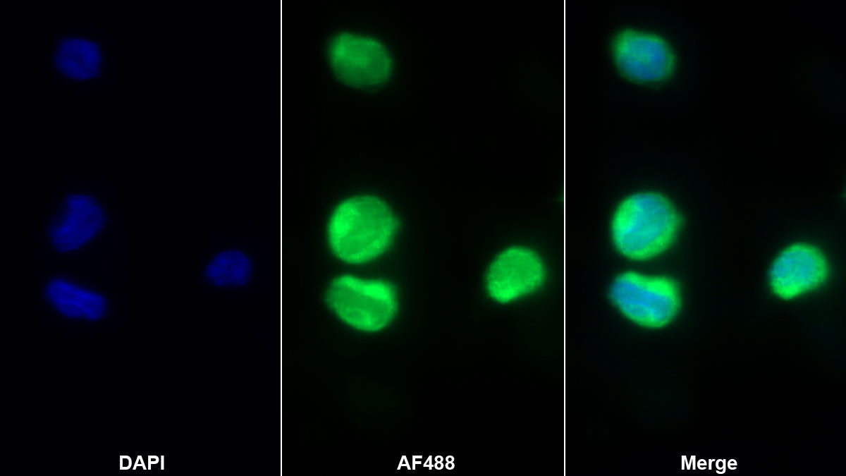 Polyclonal Antibody to Stromal Cell Derived Factor 1 (SDF1)