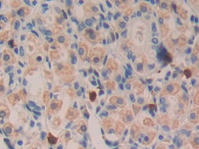 Polyclonal Antibody to Transforming Growth Factor Alpha (TGFa)