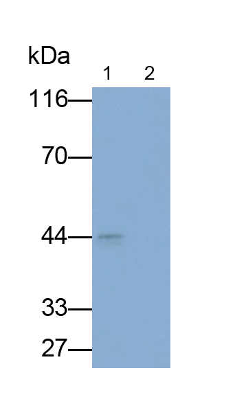 Polyclonal Antibody to Transforming Growth Factor Beta 1 (TGFb1)