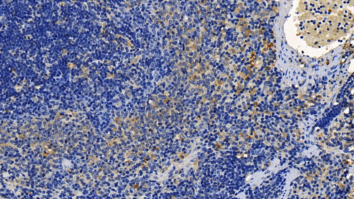 Polyclonal Antibody to Transforming Growth Factor Beta 1 (TGFb1)