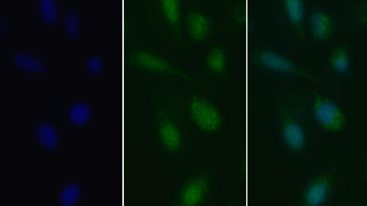 Polyclonal Antibody to Transforming Growth Factor Beta 1 (TGFb1)