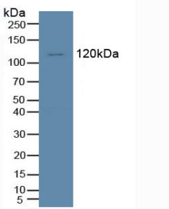 Polyclonal Antibody to Tyrosine Kinase With Immunoglobulin Like And EGF Like Domains Protein 1 (Tie1)