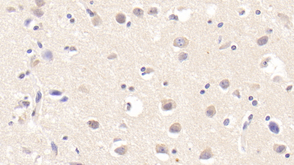 Polyclonal Antibody to Tyrosine Kinase With Immunoglobulin Like And EGF Like Domains Protein 1 (Tie1)