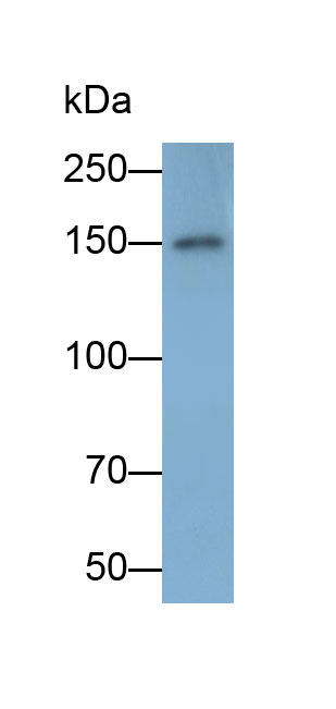 Polyclonal Antibody to Tyrosine Kinase With Immunoglobulin Like And EGF Like Domains Protein 1 (Tie1)