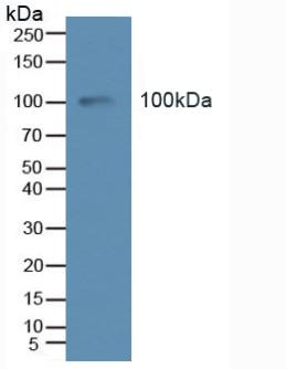 Polyclonal Antibody to TEK Tyrosine Kinase, Endothelial (Tie2)