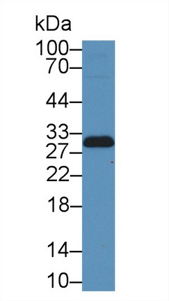 Polyclonal Antibody to Tissue Inhibitors Of Metalloproteinase 2 (TIMP2)