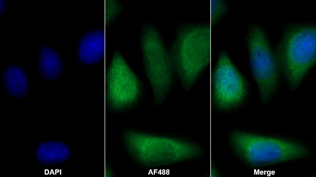 Polyclonal Antibody to Tissue Inhibitors Of Metalloproteinase 2 (TIMP2)