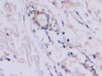 Polyclonal Antibody to Tissue Inhibitors Of Metalloproteinase 2 (TIMP2)