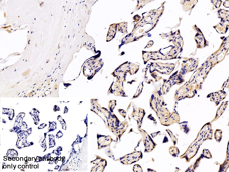 Polyclonal Antibody to Tissue Inhibitors Of Metalloproteinase 2 (TIMP2)