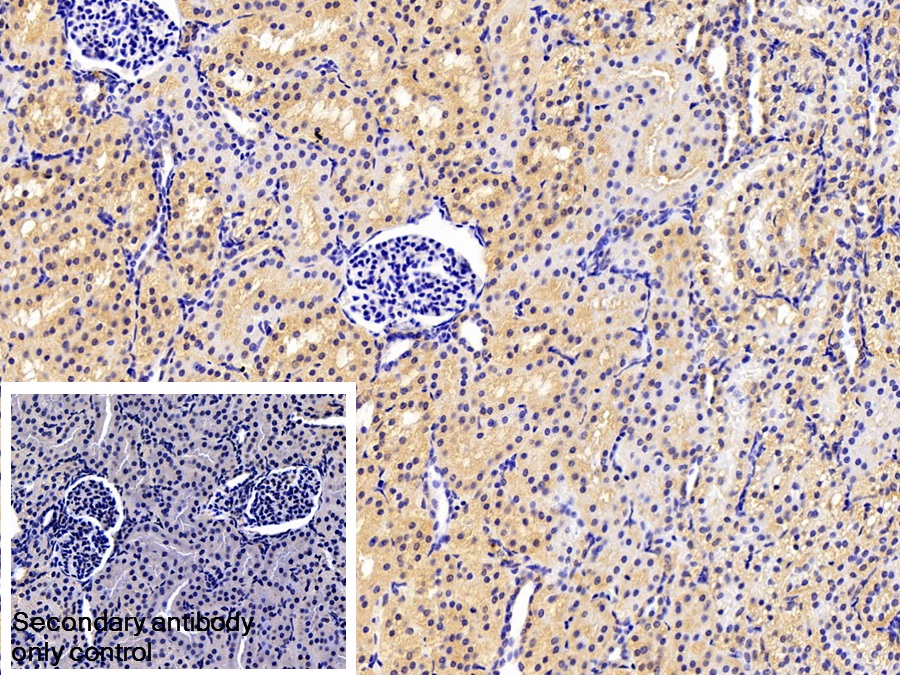 Polyclonal Antibody to Tissue Inhibitors Of Metalloproteinase 2 (TIMP2)