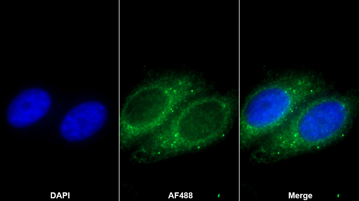 Polyclonal Antibody to Tissue Inhibitors Of Metalloproteinase 3 (TIMP3)