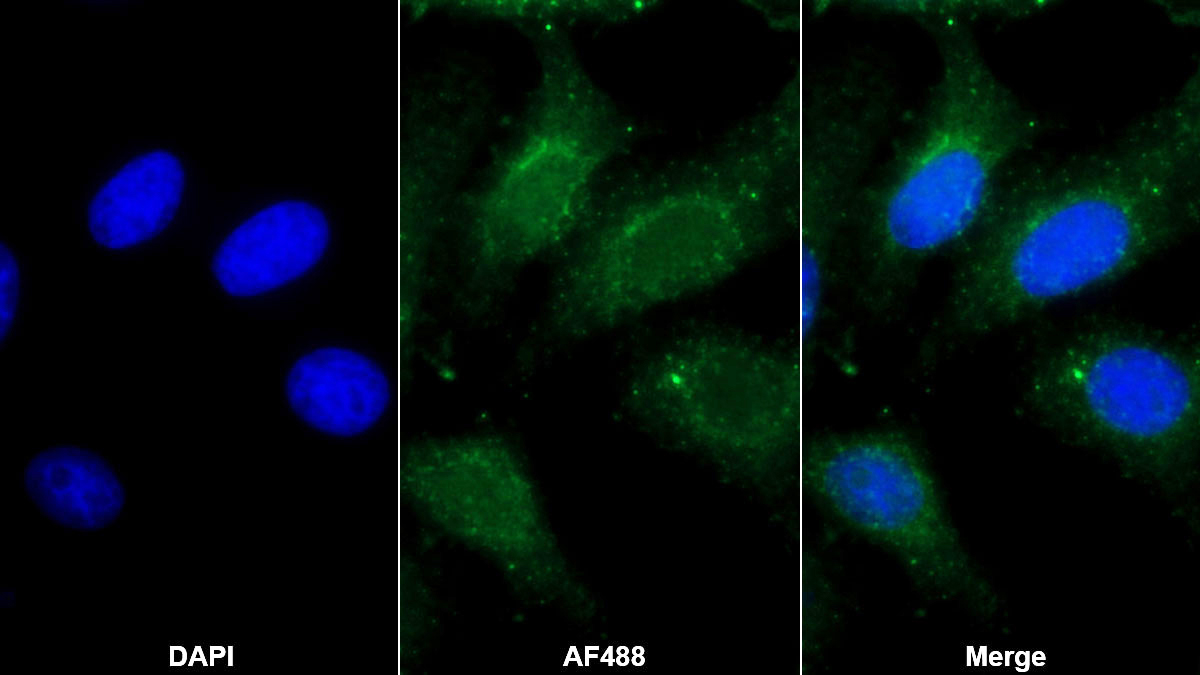 Polyclonal Antibody to Tissue Inhibitors Of Metalloproteinase 3 (TIMP3)