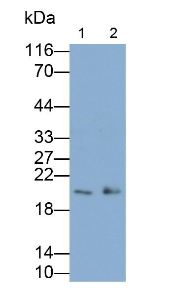 Polyclonal Antibody to Tissue Inhibitors Of Metalloproteinase 3 (TIMP3)