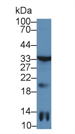 Polyclonal Antibody to Tissue Inhibitors Of Metalloproteinase 3 (TIMP3)