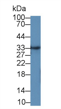 Polyclonal Antibody to Tissue Inhibitors Of Metalloproteinase 3 (TIMP3)