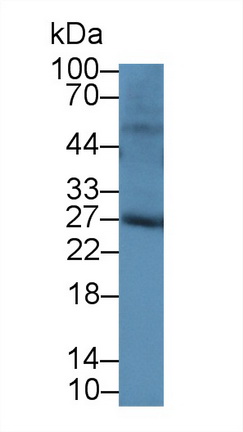 Polyclonal Antibody to Tissue Inhibitors Of Metalloproteinase 4 (TIMP4)