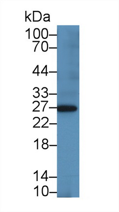 Polyclonal Antibody to Tissue Inhibitors Of Metalloproteinase 4 (TIMP4)