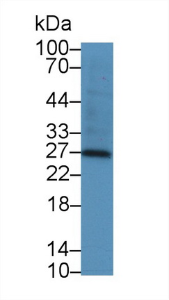 Polyclonal Antibody to Tissue Inhibitors Of Metalloproteinase 4 (TIMP4)