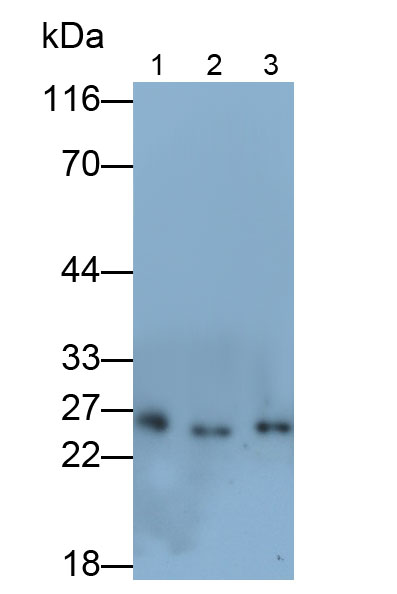 Polyclonal Antibody to Tissue Inhibitors Of Metalloproteinase 4 (TIMP4)