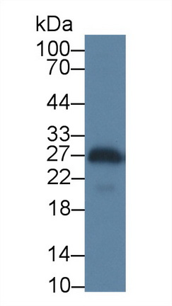 Polyclonal Antibody to Tissue Inhibitors Of Metalloproteinase 4 (TIMP4)