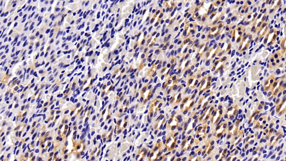 Polyclonal Antibody to Tissue Inhibitors Of Metalloproteinase 4 (TIMP4)