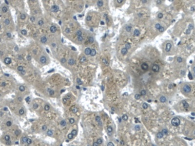 Polyclonal Antibody to Transforming Growth Factor Beta Induced Protein (TGFbI)