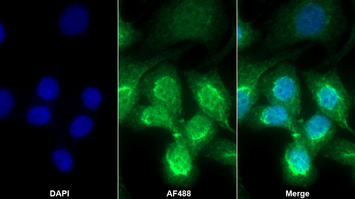 Polyclonal Antibody to Transforming Growth Factor Beta Induced Protein (TGFbI)