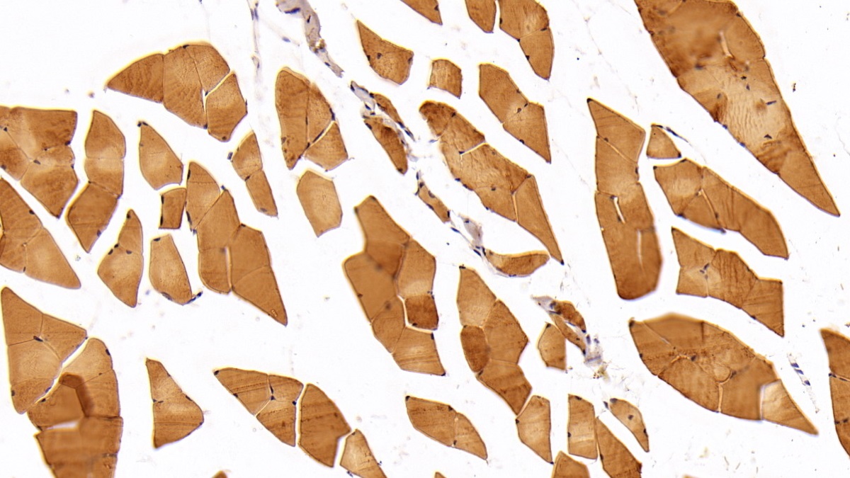 Polyclonal Antibody to Adiponectin Receptor 2 (ADIPOR2)