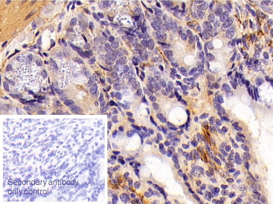 Polyclonal Antibody to Adiponectin Receptor 2 (ADIPOR2)