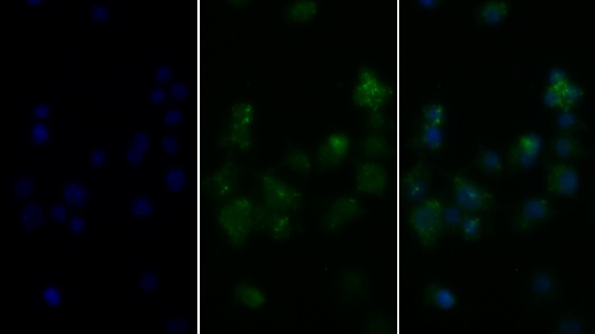 Polyclonal Antibody to Tumor Necrosis Factor Alpha (TNFa)