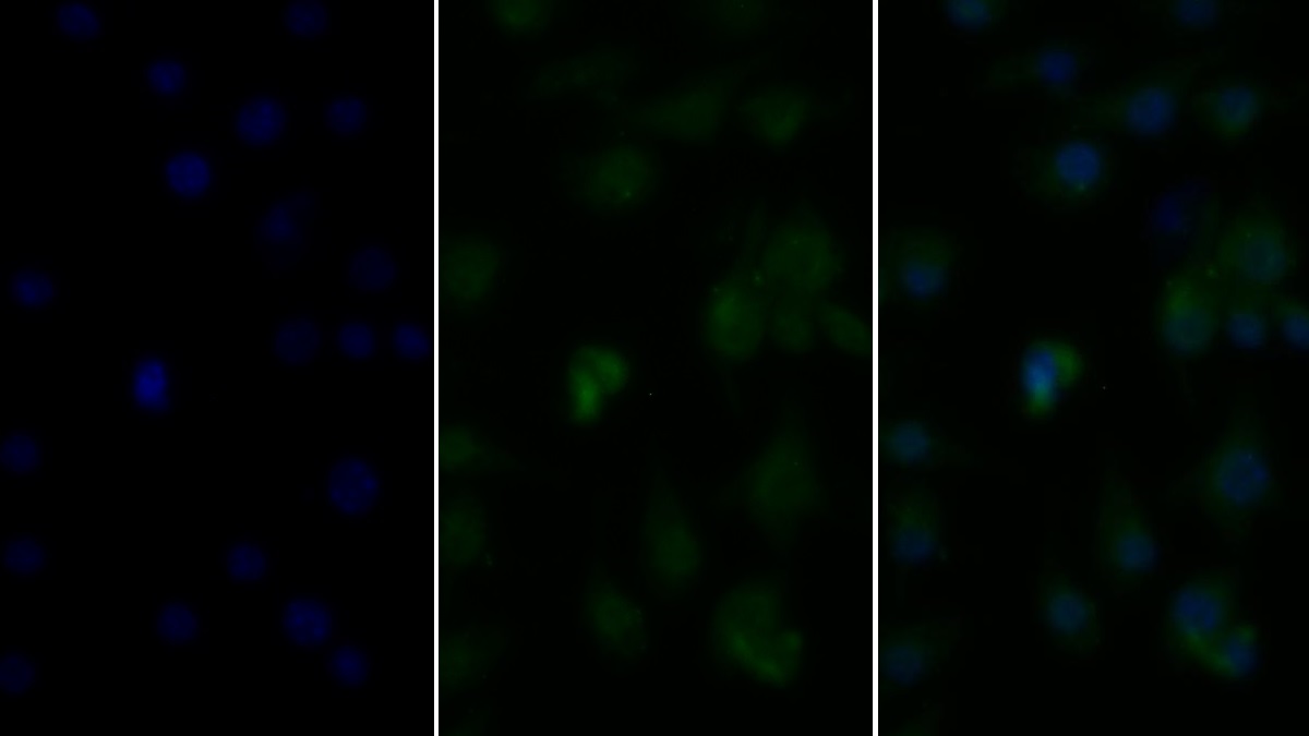 Polyclonal Antibody to Tumor Necrosis Factor Alpha (TNFa)