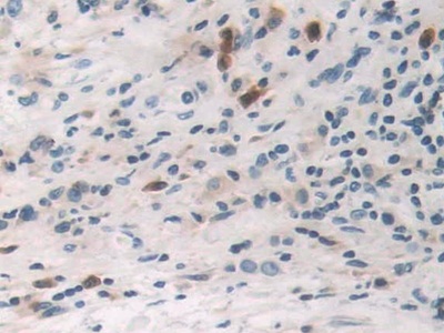 Polyclonal Antibody to Tumor Necrosis Factor Alpha (TNFa)