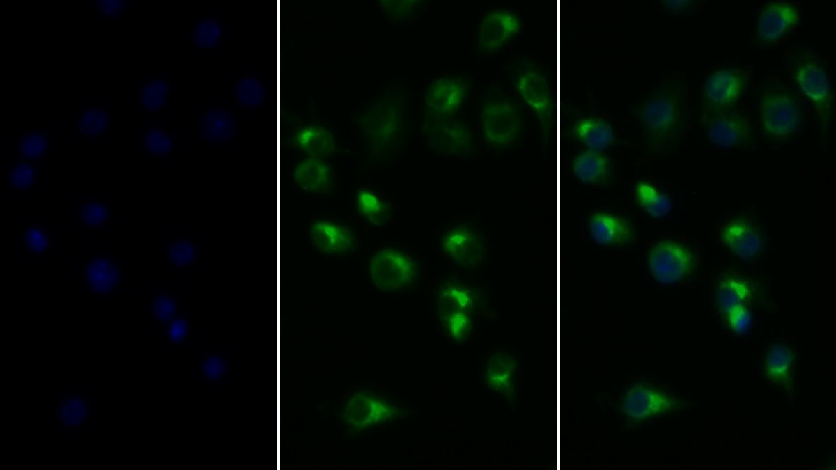 Polyclonal Antibody to Tumor Necrosis Factor Alpha (TNFa)