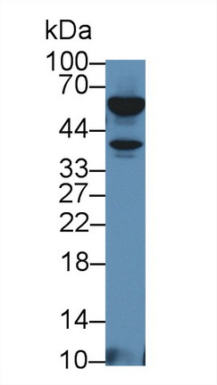 Polyclonal Antibody to Tumor Necrosis Factor Beta (TNFb)